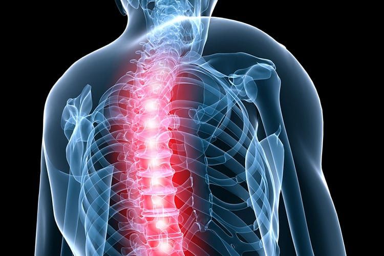 Spinal Cord Stimulation - Delaware Valley Pain & Spine InstituteChalfont  Pain Management