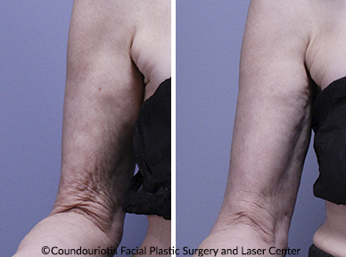 Genesis B&A1