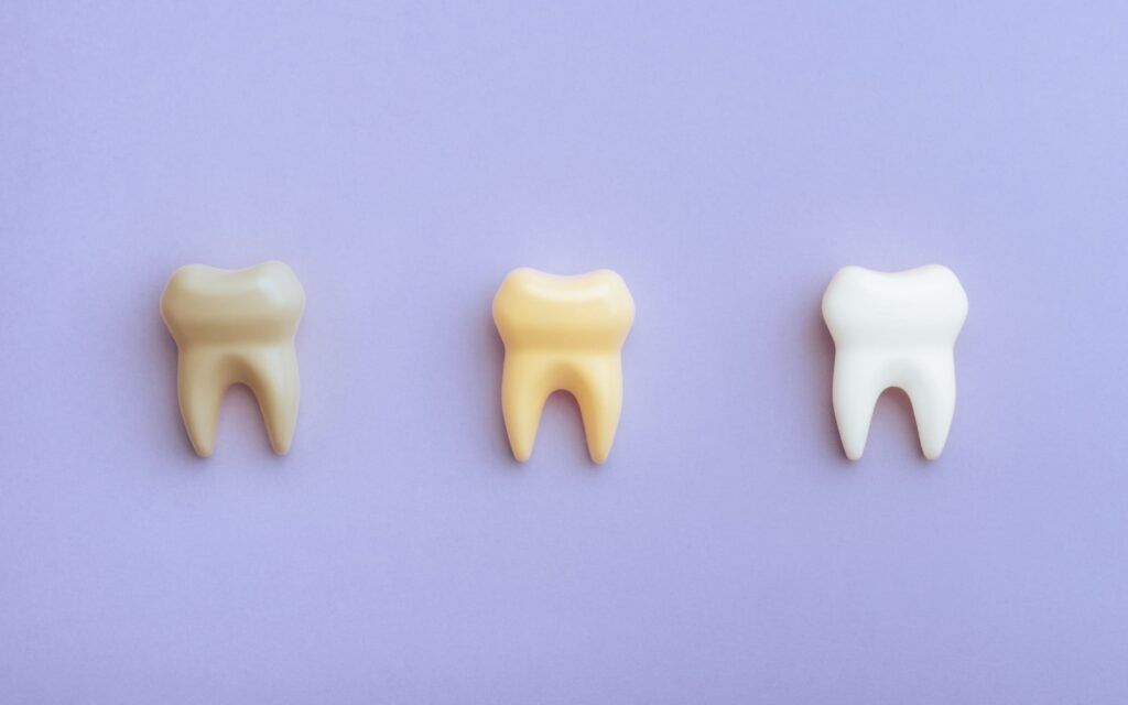 Three Teeth Examples Going From Stained To Clean