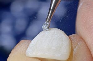 close up of a dental crown being properly shaped