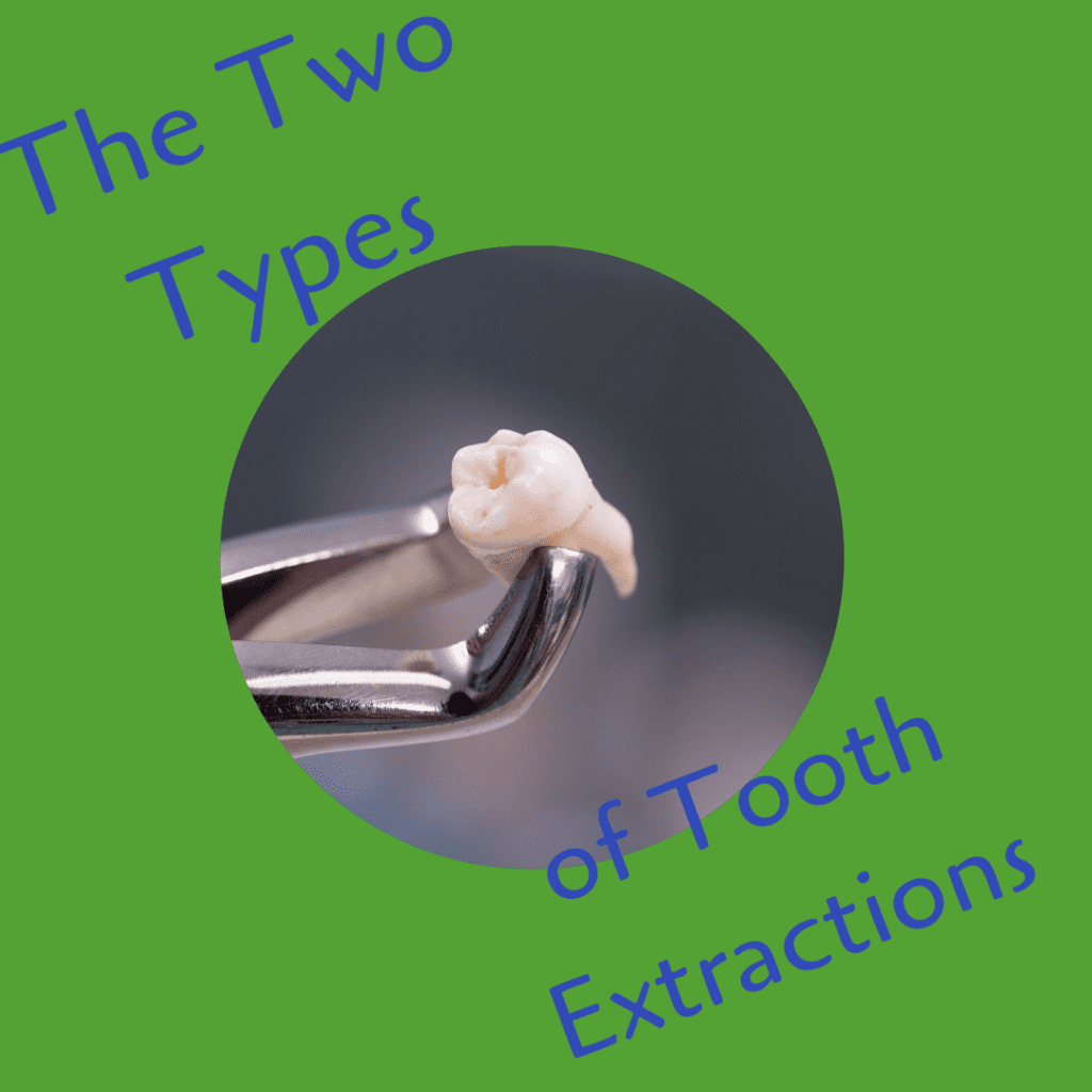 The 2 Types of Tooth Extractions