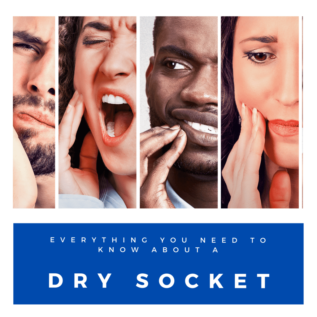 Everything You must know about Dry Socket