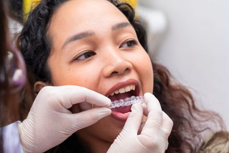 Dentist demonstrates and inserts clear aligners for a young female patient as part of modern invisible braces orthodontic therapy.