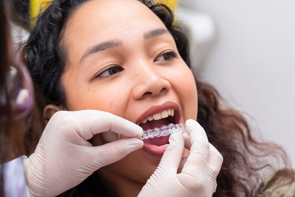 Dentist demonstrates and inserts clear aligners for a young female patient as part of modern invisible braces orthodontic therapy.