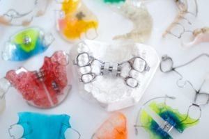 child orthodontic appliances