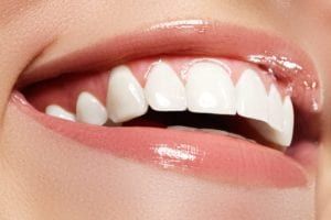 Teeth Whitening Closeup image
