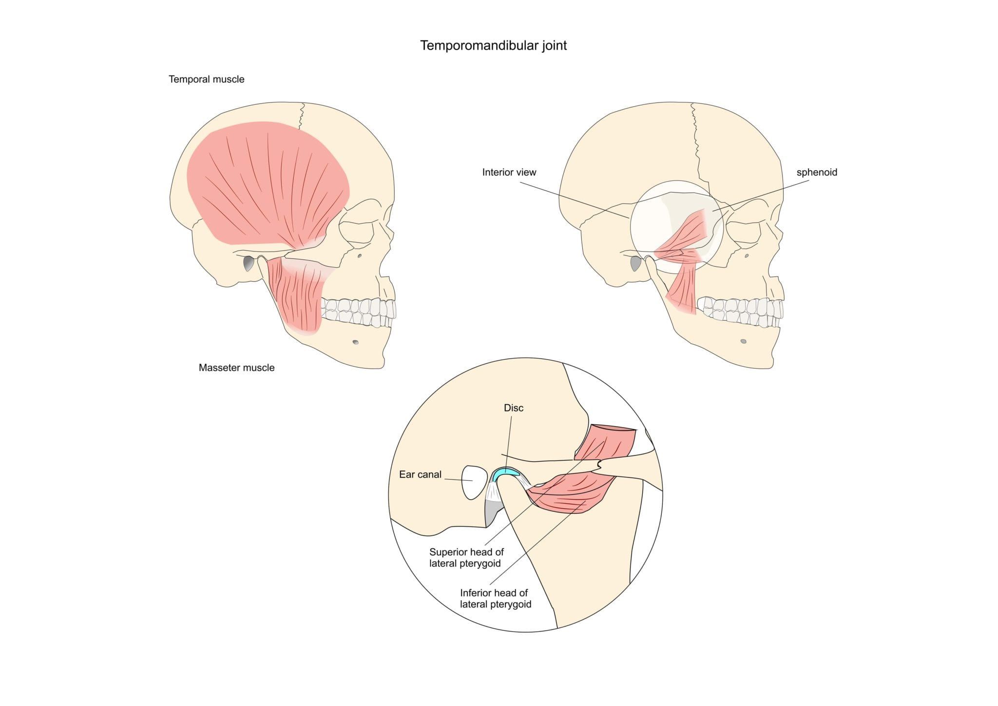 TMJ Treatment - Glendale, CA - Massih Orthodontics