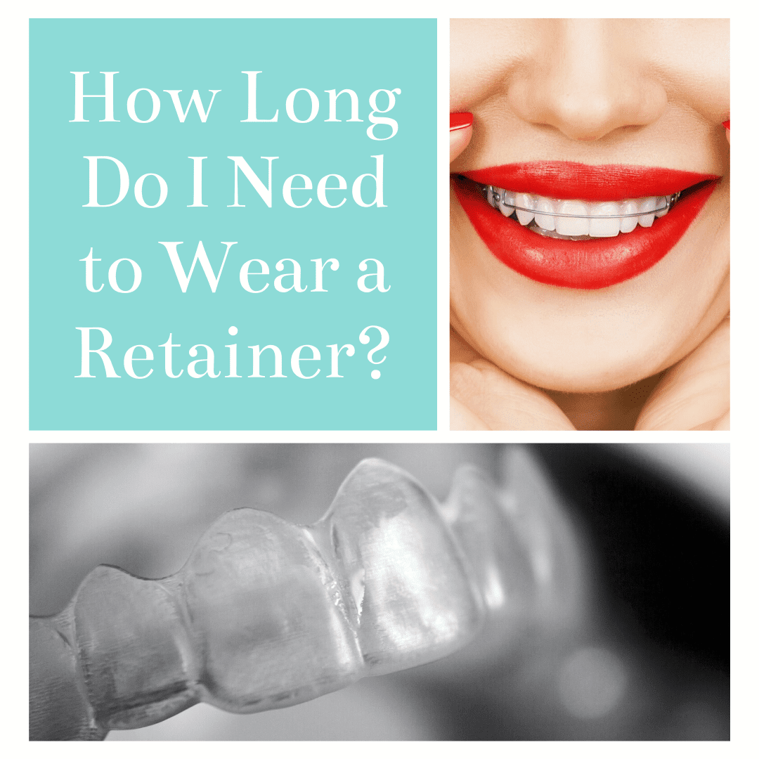 retainer for teeth before and after