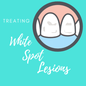 Treating White Spot Lesions (1)