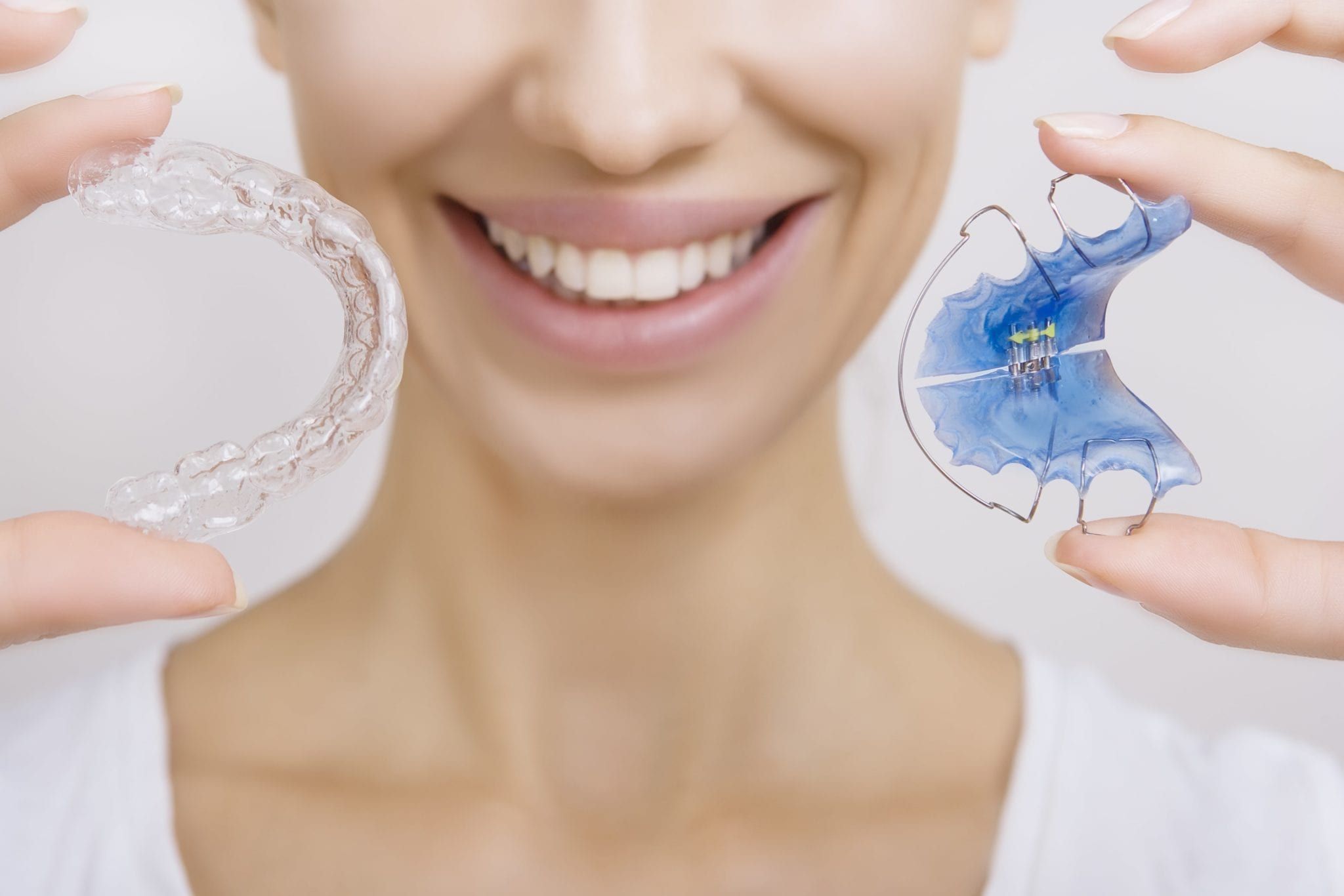 How Long Do I Need to Wear a Retainer?