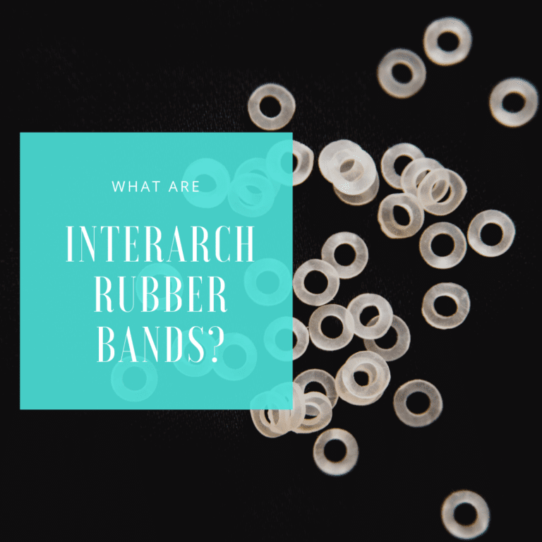 What Are Interarch Rubber Bands?