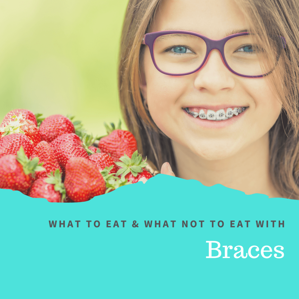 What to Eat & What Not to Eat with Braces