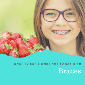What to Eat and What Not to Eat with Braces