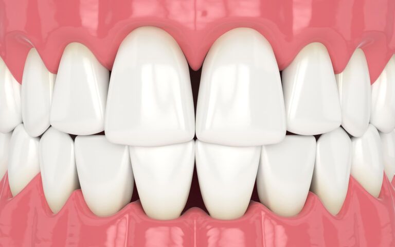 Dental Tooth Triangles Vector Image