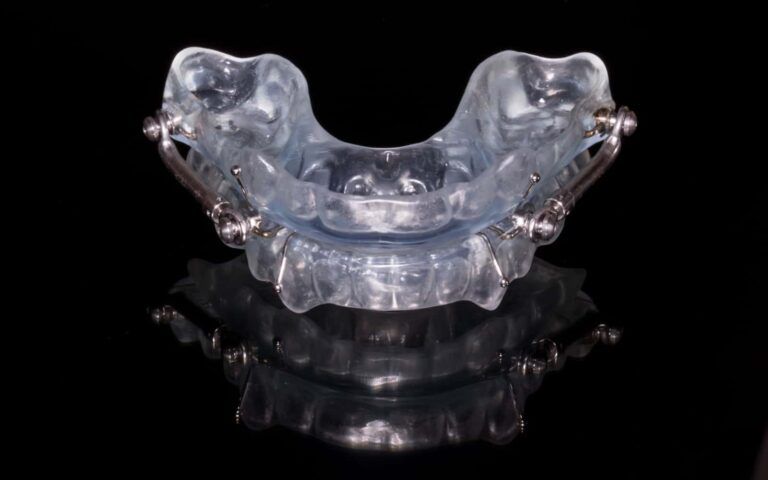 orthodontic sleep apnea appliance