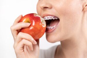 Close up of young woman with braces biting off red apple