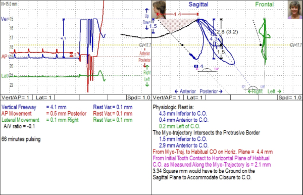 ing2