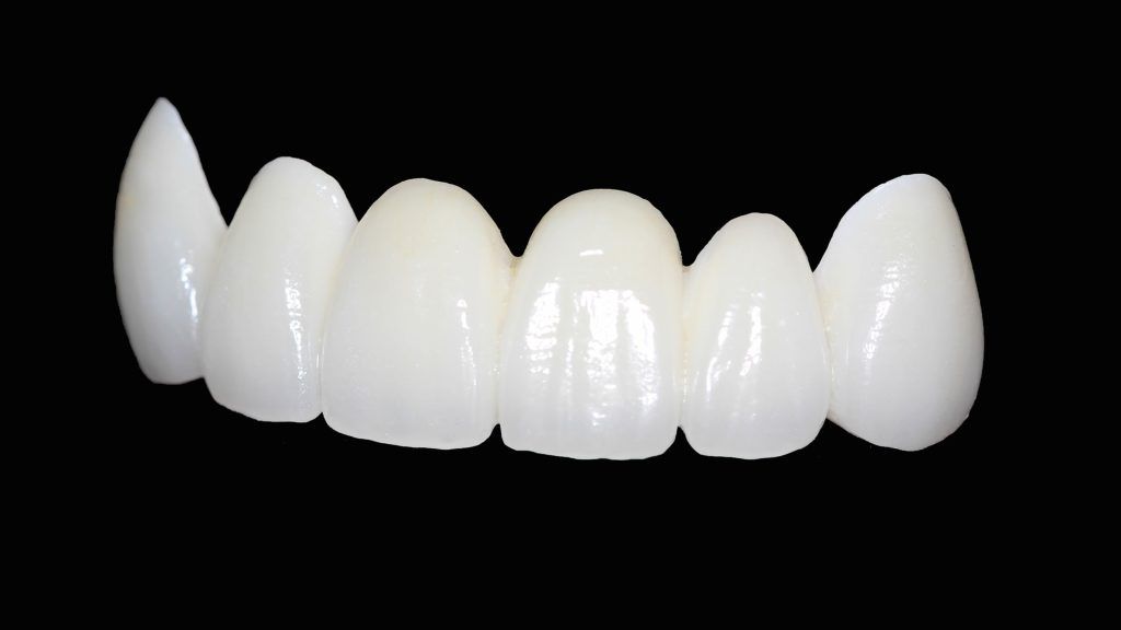 What are Zirconia Crowns?