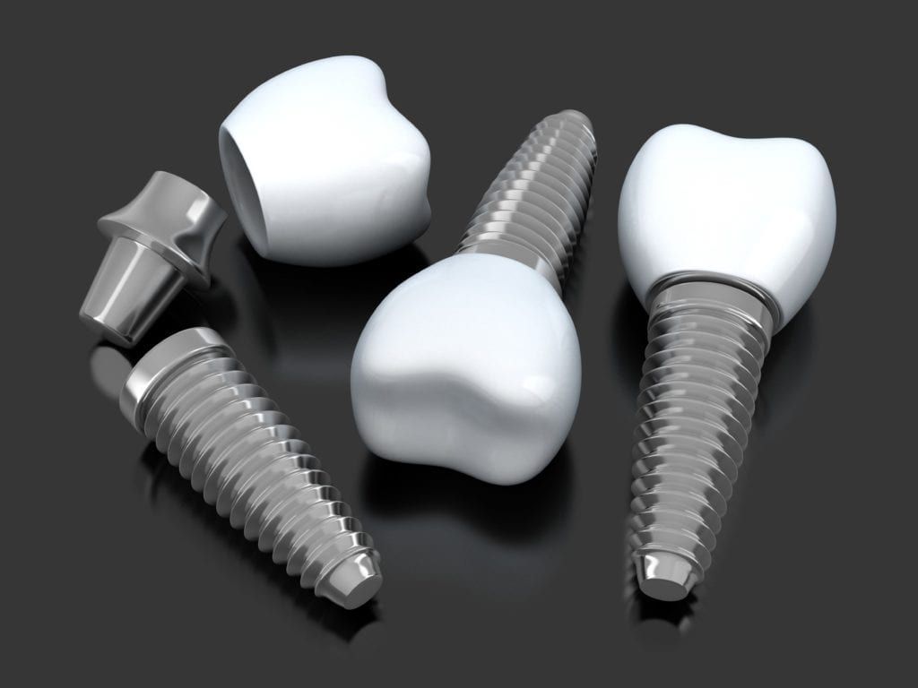 Multiple dental implants on a black background