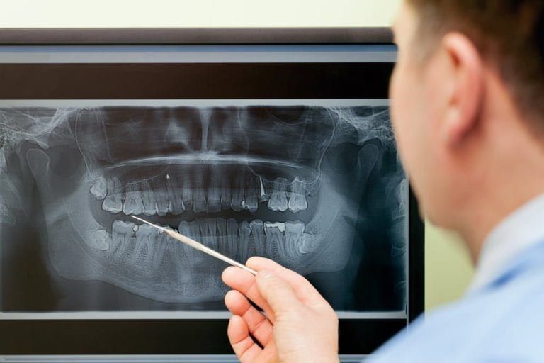 Dentist checking Digital-X-Rays