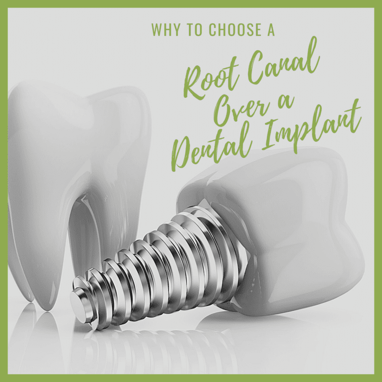 Why to Choose a Root Canal Over Dental Implants