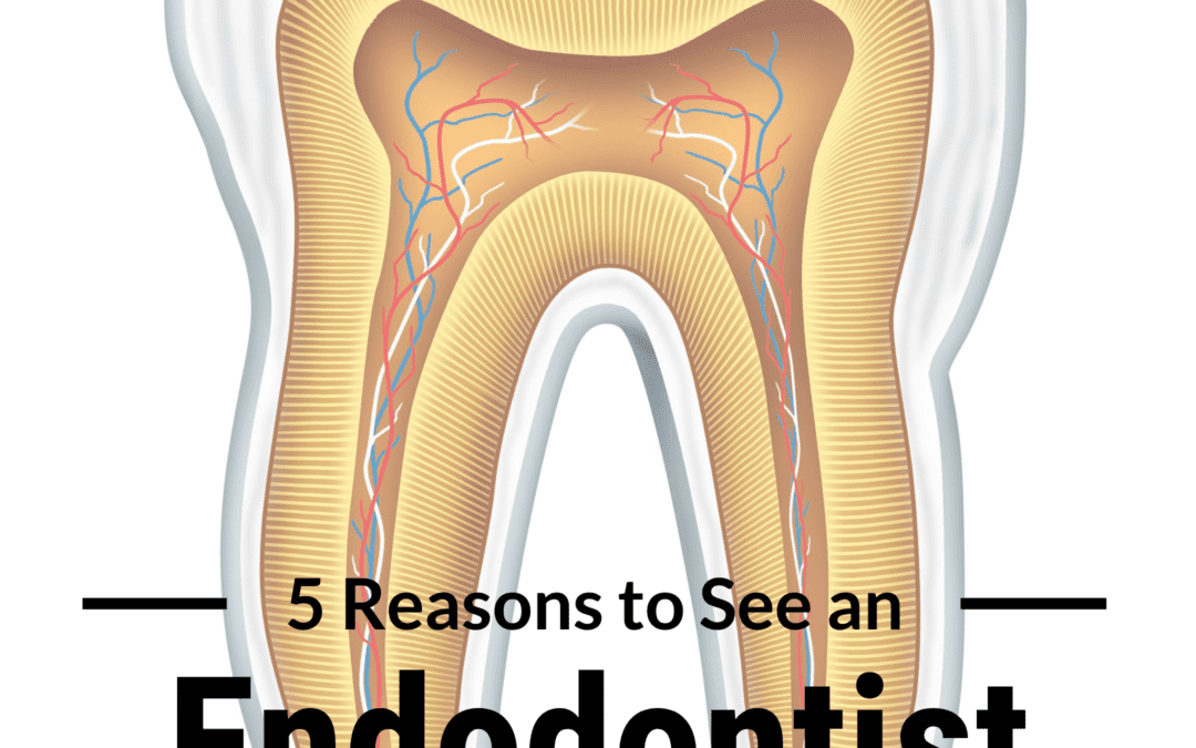 5 Reasons to See an Endodontist