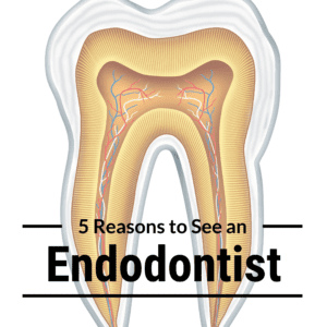 5 Reasons to See an Endodontist