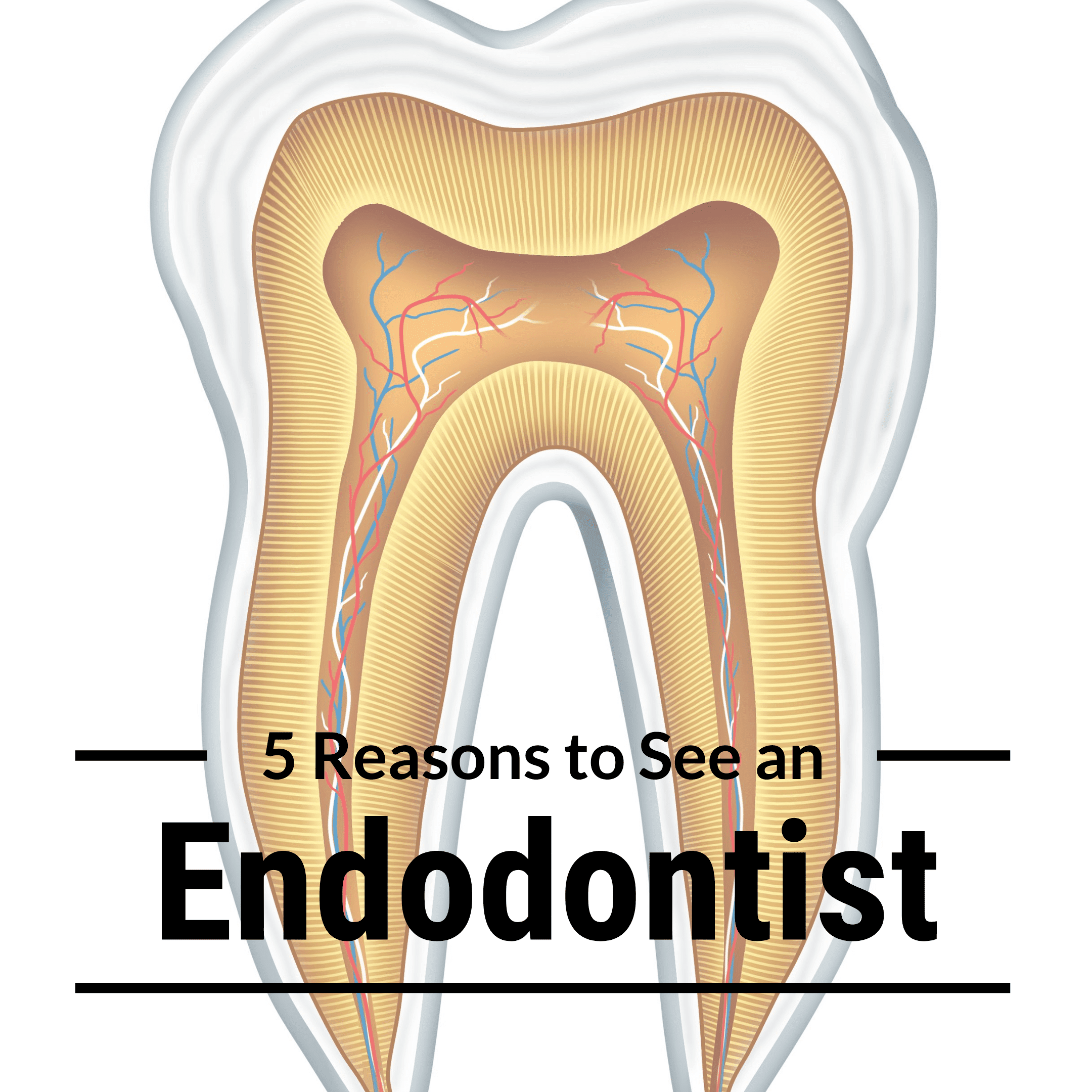 Root Canal Explained - American Association of Endodontists