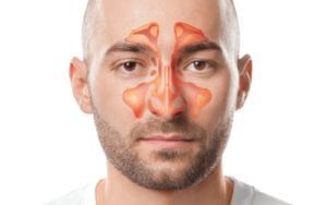 Man with sinuses highlighted