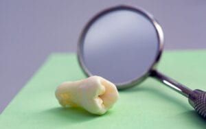 Tooth That Has Had A Pulpectomy
