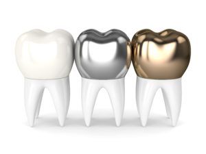 types of dental crowns