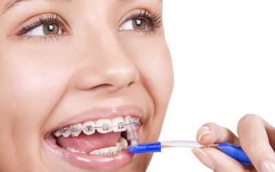 Orthodontic Post-Op Instructions