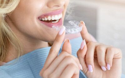 Clear Aligners/Invisalign