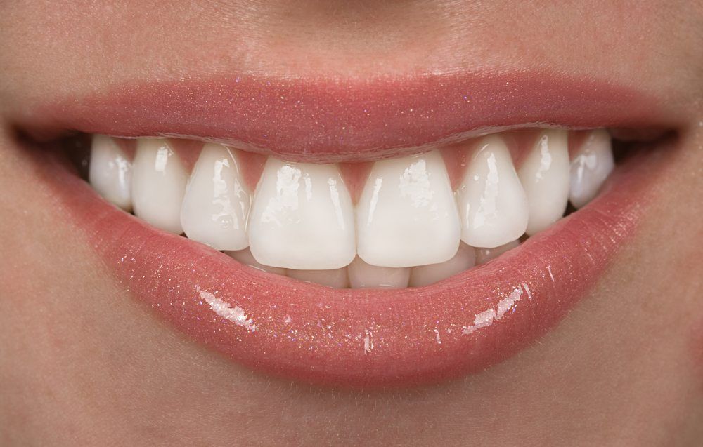 Porcelain Veneers Images 08