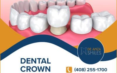 Why should I get dental implants for a better smile?