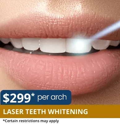 Laser Teeth Whitening