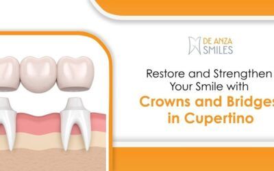 Restore and Strengthen Your Smile with Crowns and Bridges in Cupertino