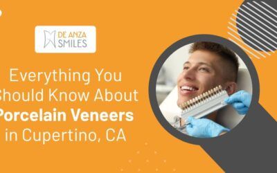 Everything You Should Know About Porcelain Veneers in Cupertino, CA