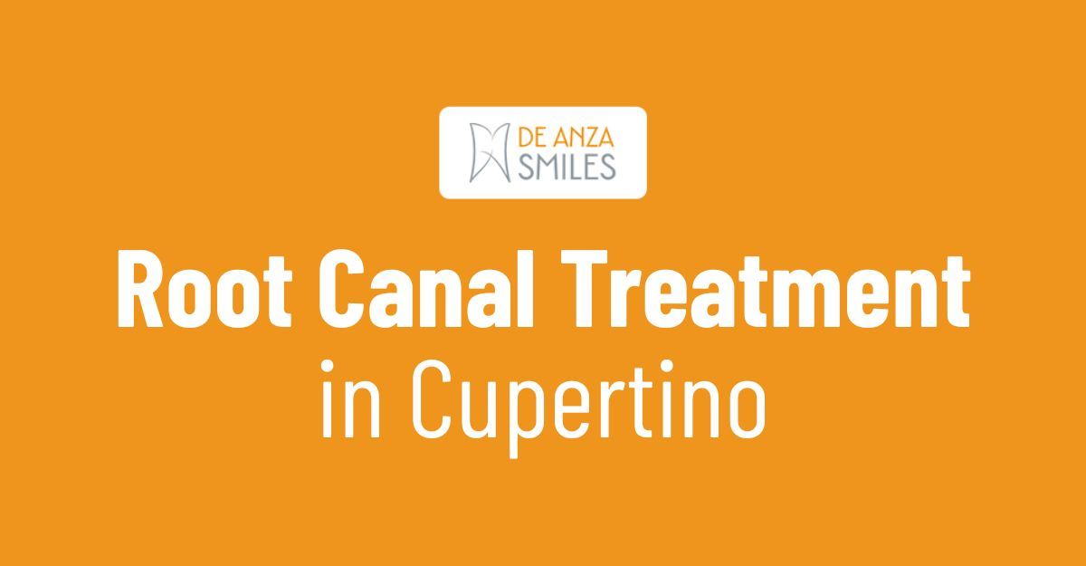 Root Canal Treatment in Cupertino: Your Guide to Pain Relief and Tooth Preservation