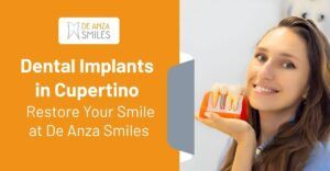 Dental Implants in Cupertino