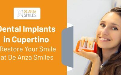 Dental Implants in Cupertino – Restore Your Smile at De Anza Smiles