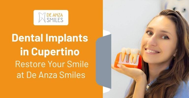 Dental Implants in Cupertino