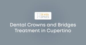 Dental Crowns and Bridges Treatment in Cupertino