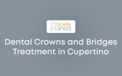 Dental Crowns and Bridges Treatment in Cupertino