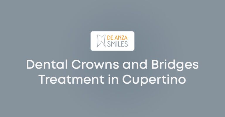 Dental Crowns and Bridges Treatment in Cupertino