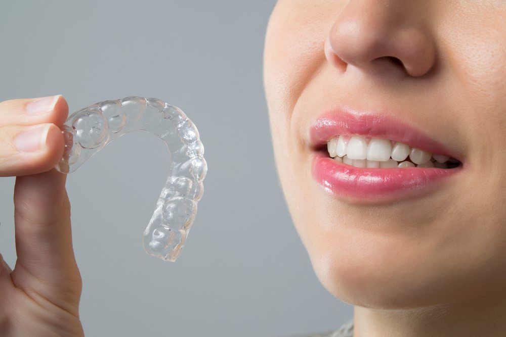 Invisalign