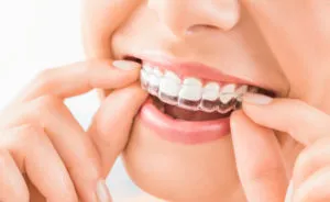 teeth cover cap