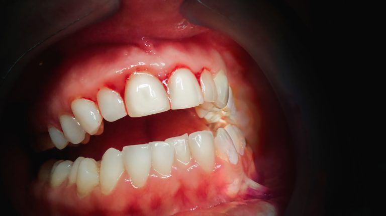 Close up teeth image