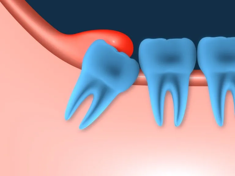 Teeth closeup image