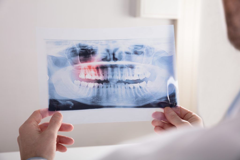 Dentist hands holding a panoramic dental xray